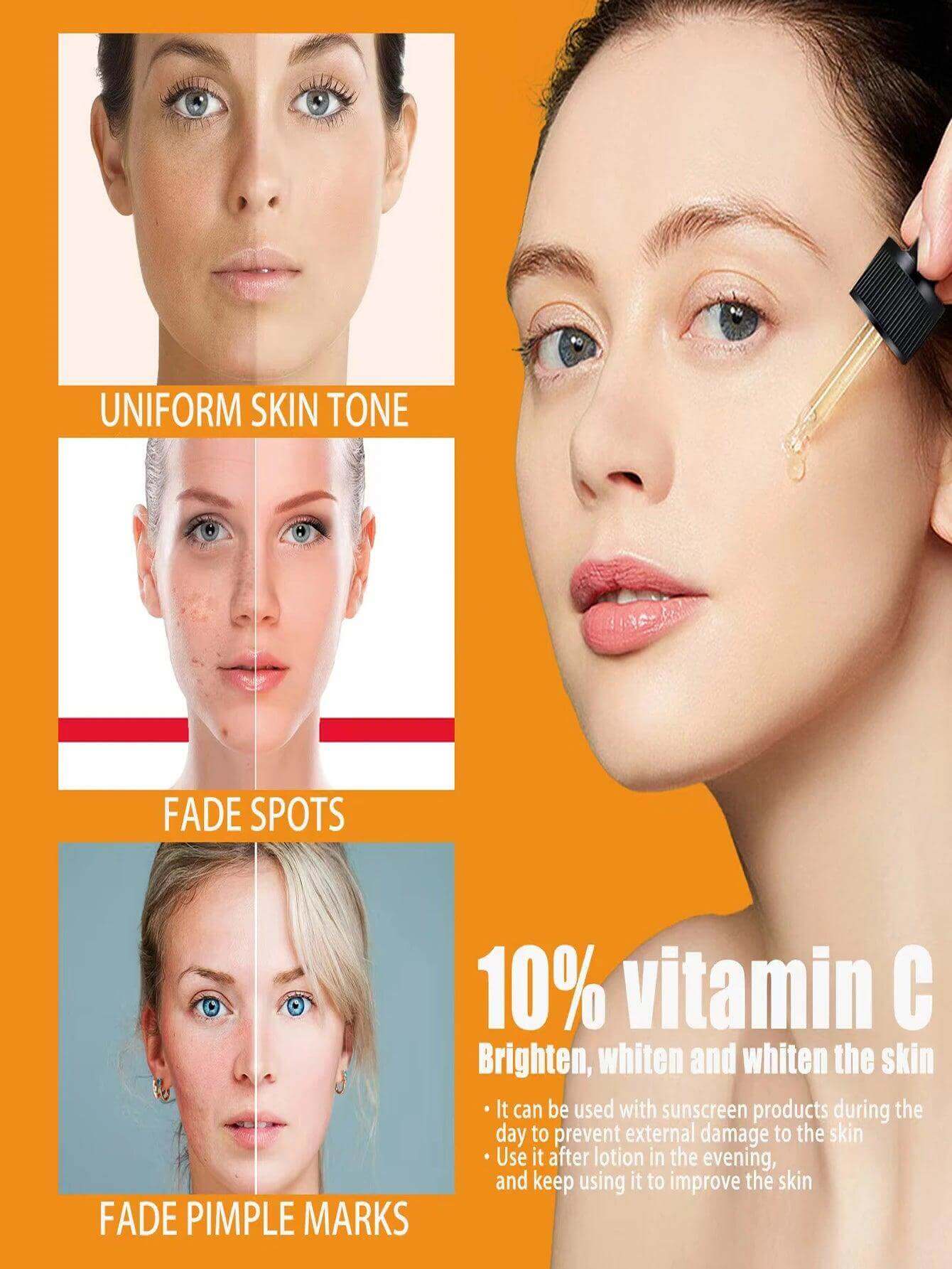 Vitamin C Facial Serum - Dark Spot Remover & Whitening - Viva Bella