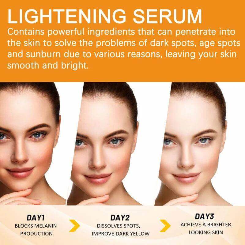 Vitamin C Facial Serum - Dark Spot Remover & Whitening - Viva Bella