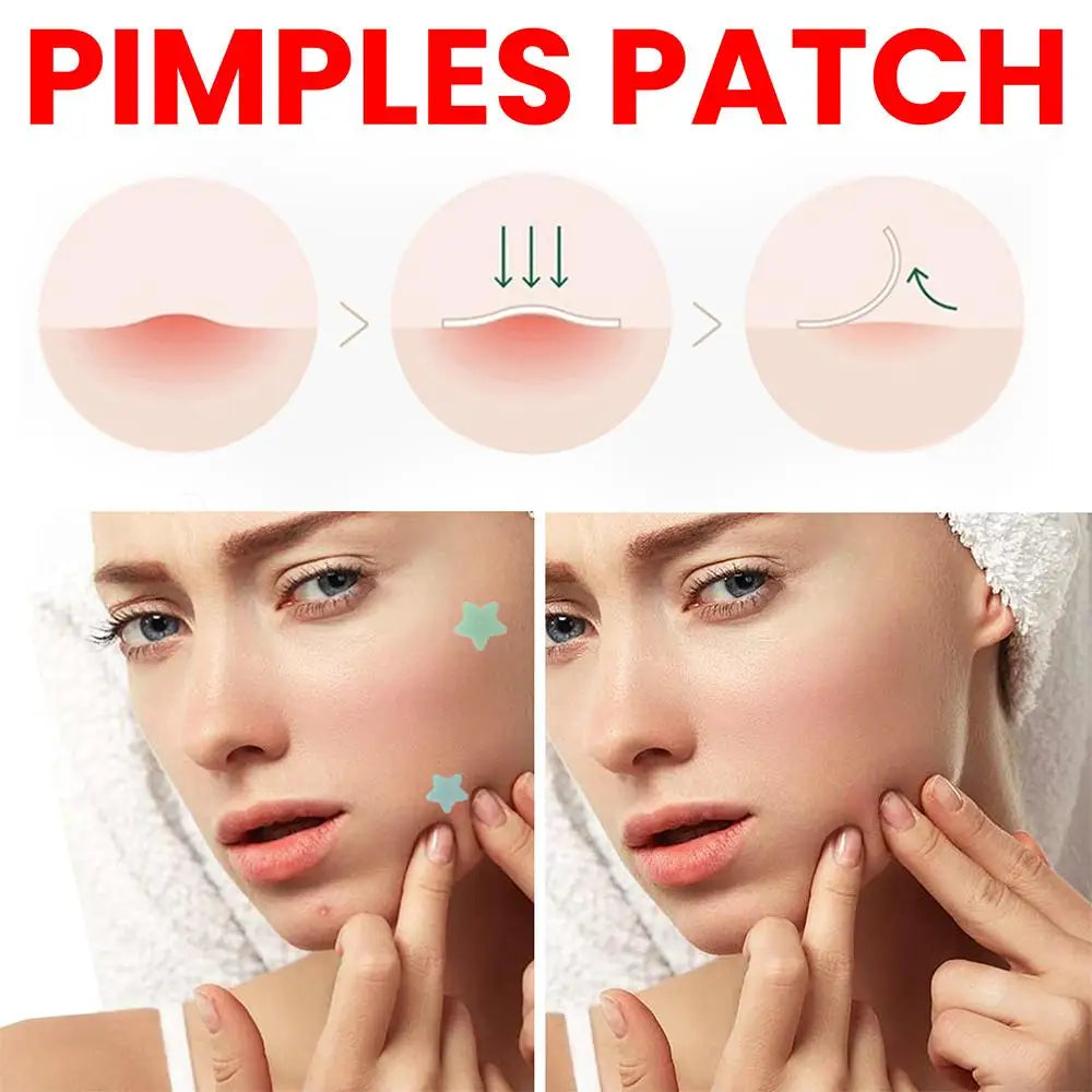 Invisible Acne Removal Skin Care Stickers