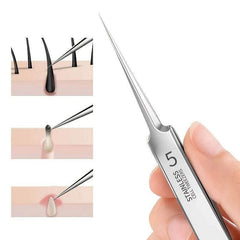 Blackhead Tweezers - Acne Needle & Facial Removal Tool - Viva Bella